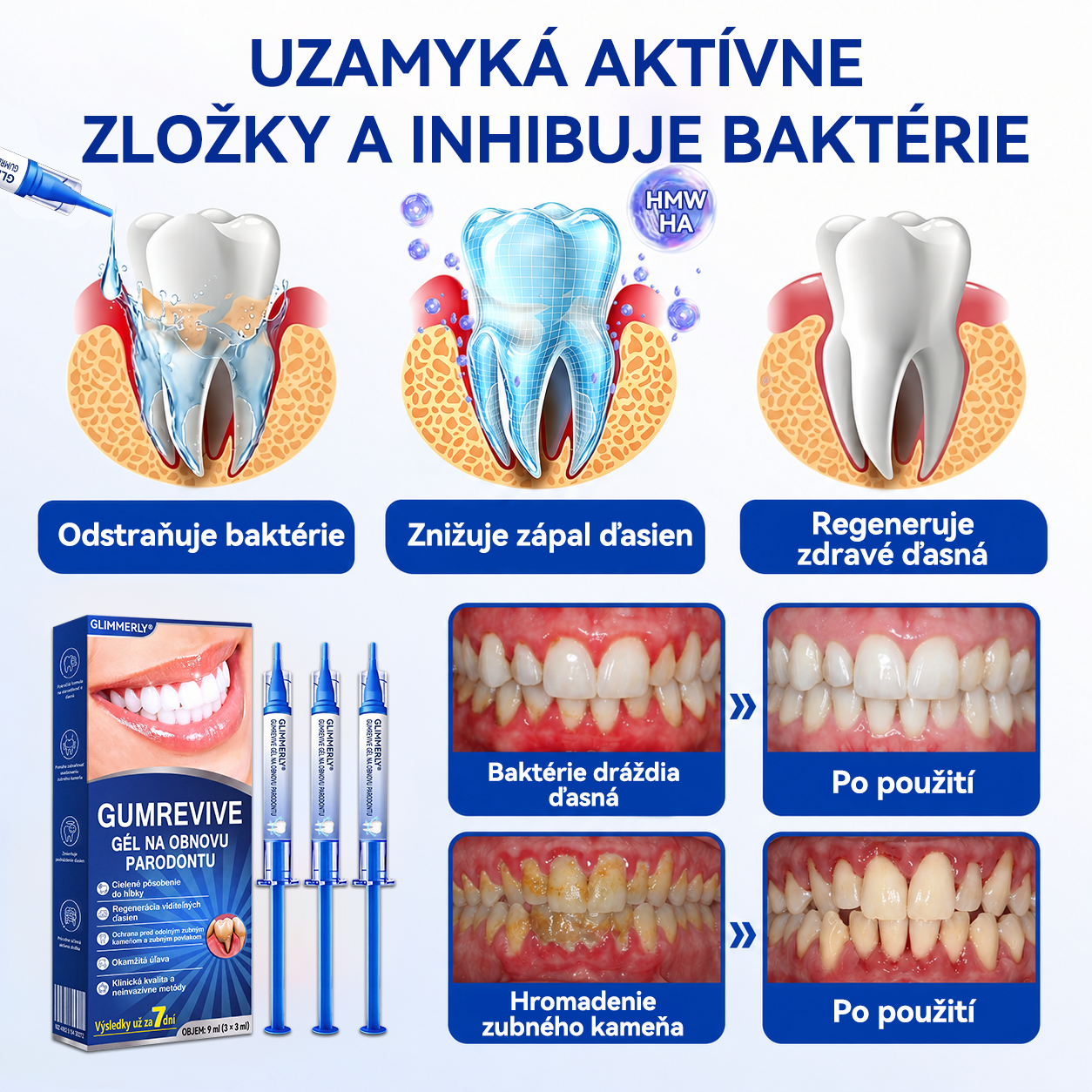 🥇𝑮𝒍𝒊𝒎𝒎𝒆𝒓𝒍𝒚® 🦷 𝑮𝒖𝒎𝑹𝒆𝒗𝒊𝒗𝒆 – gél na obnovu parodontu