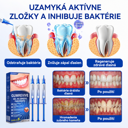 🥇𝑮𝒍𝒊𝒎𝒎𝒆𝒓𝒍𝒚® 🦷 𝑮𝒖𝒎𝑹𝒆𝒗𝒊𝒗𝒆 – gél na obnovu parodontu