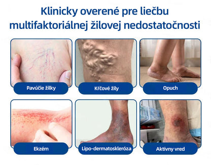 👩‍⚕️✅ Healrize® VeinTarget mikrojihlová náplasť ⚡ Okamžitá úľava, dlhodobé výsledky