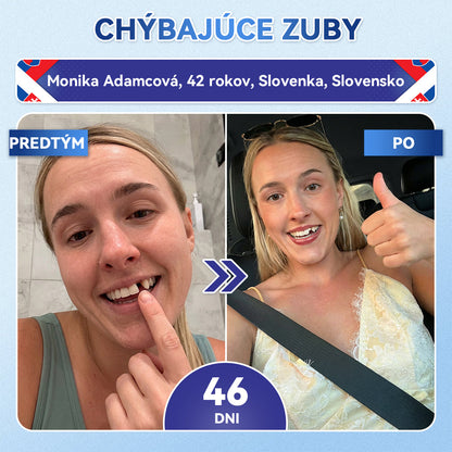🦷𝐆𝐥𝐢𝐦𝐦𝐞𝐫𝐥𝐲® Tideglusib zuby a dasna Opravná náplasť s mikroihlami  | Pokročilé zubné pásiky s aktiváciou kmeňových buniek (obnova skloviny a dentínu • posilnenie ďasien • odstránenie zubného kameňa a zápachu • zastavenie citlivosti zubov)