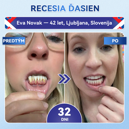 🦷𝐆𝐥𝐢𝐦𝐦𝐞𝐫𝐥𝐲® Tideglusib zuby a dasna Opravná náplasť s mikroihlami  | Pokročilé zubné pásiky s aktiváciou kmeňových buniek (obnova skloviny a dentínu • posilnenie ďasien • odstránenie zubného kameňa a zápachu • zastavenie citlivosti zubov)