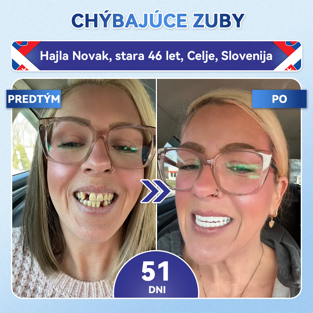 🦷𝐆𝐥𝐢𝐦𝐦𝐞𝐫𝐥𝐲® Tideglusib zuby a dasna Opravná náplasť s mikroihlami  | Pokročilé zubné pásiky s aktiváciou kmeňových buniek (obnova skloviny a dentínu • posilnenie ďasien • odstránenie zubného kameňa a zápachu • zastavenie citlivosti zubov)