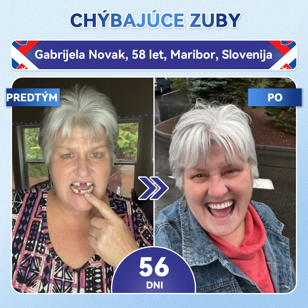 🦷𝐆𝐥𝐢𝐦𝐦𝐞𝐫𝐥𝐲® Tideglusib zuby a dasna Opravná náplasť s mikroihlami  | Pokročilé zubné pásiky s aktiváciou kmeňových buniek (obnova skloviny a dentínu • posilnenie ďasien • odstránenie zubného kameňa a zápachu • zastavenie citlivosti zubov)