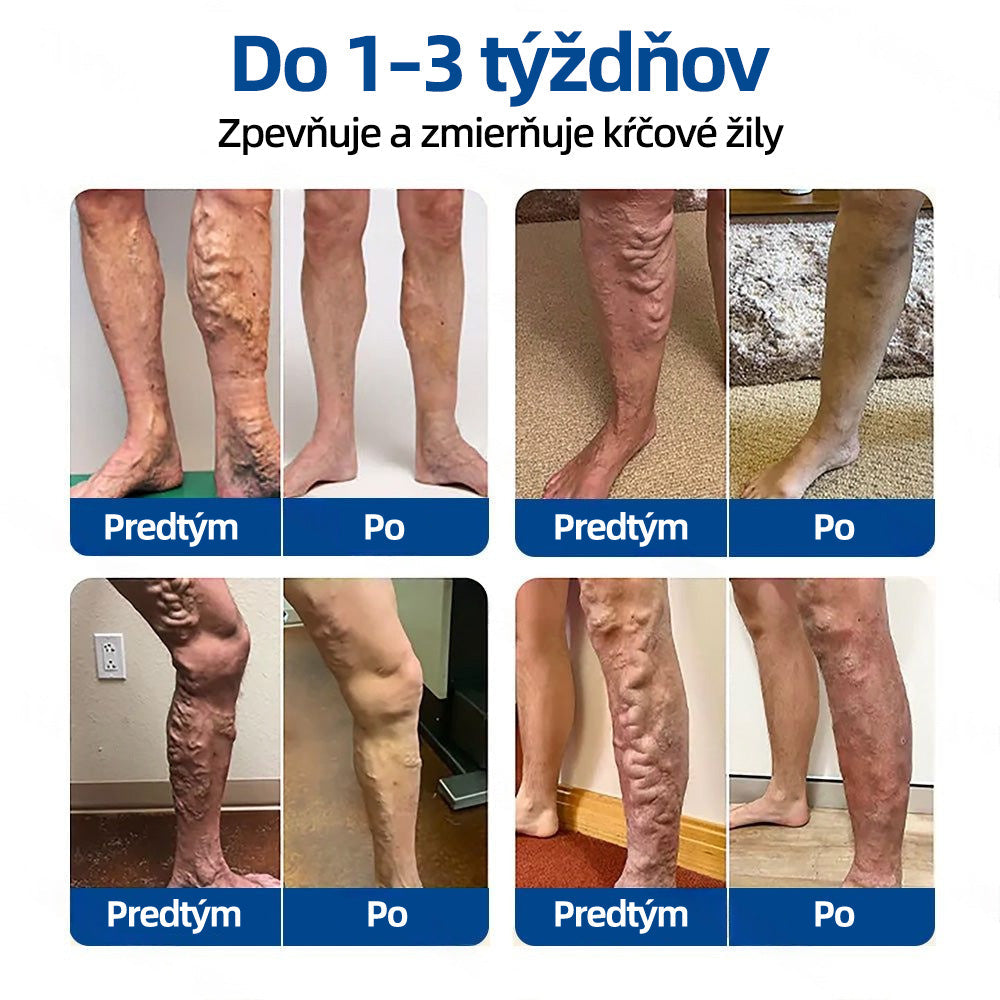 👩‍⚕️✅ Healrize® VeinTarget mikrojihlová náplasť ⚡ Okamžitá úľava, dlhodobé výsledky