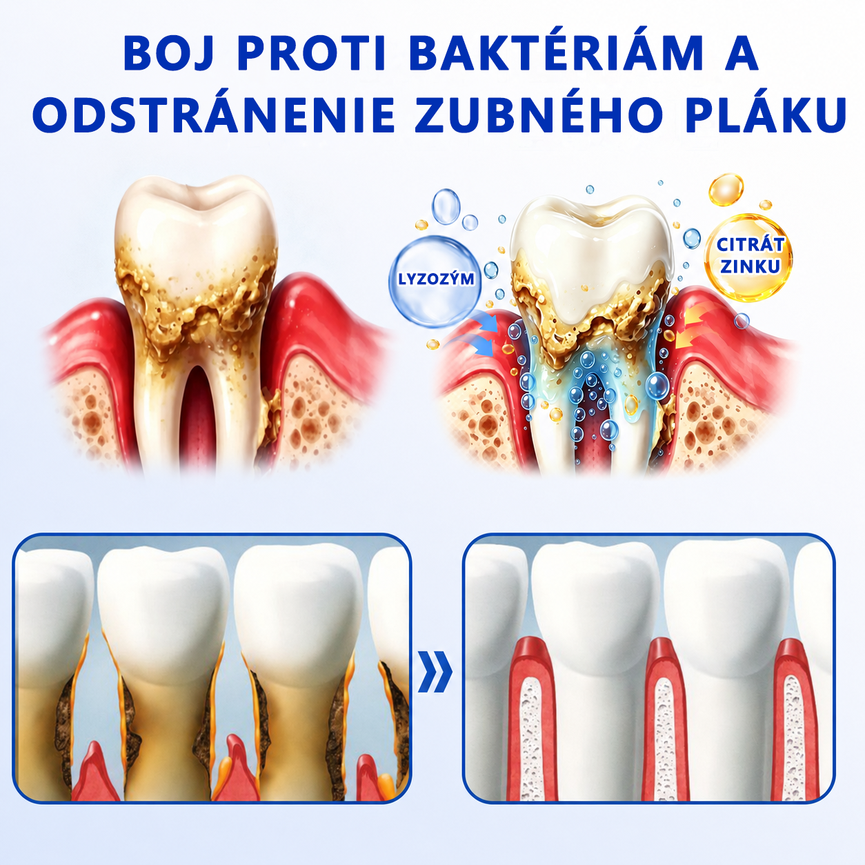 🥇𝑮𝒍𝒊𝒎𝒎𝒆𝒓𝒍𝒚® 🦷 𝑮𝒖𝒎𝑹𝒆𝒗𝒊𝒗𝒆 – gél na obnovu parodontu