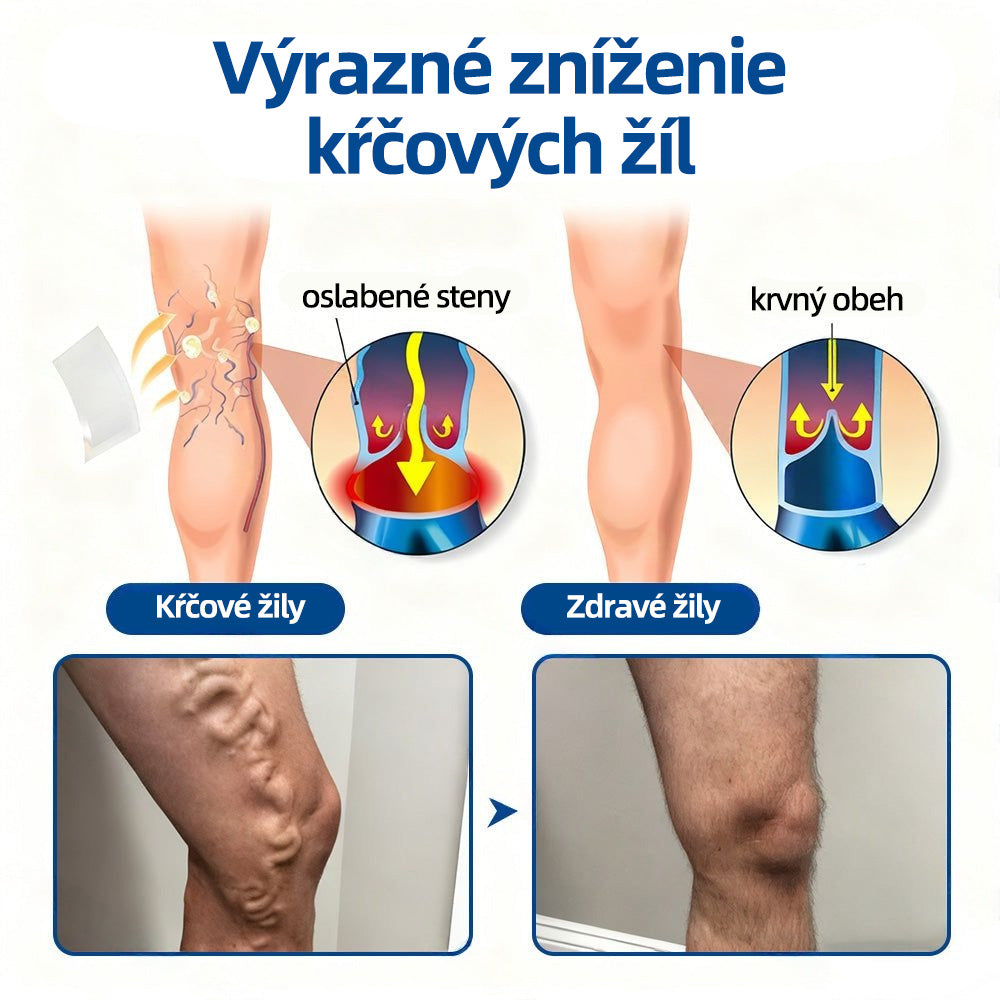👩‍⚕️✅ Healrize® VeinTarget mikrojihlová náplasť ⚡ Okamžitá úľava, dlhodobé výsledky
