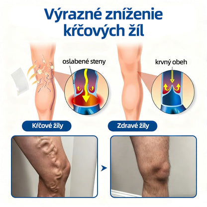 👩‍⚕️✅ Healrize® VeinTarget mikrojihlová náplasť ⚡ Okamžitá úľava, dlhodobé výsledky