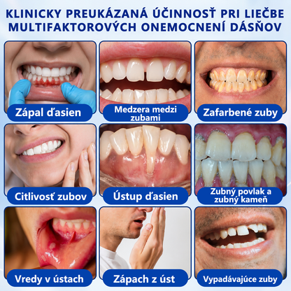 🥇𝑮𝒍𝒊𝒎𝒎𝒆𝒓𝒍𝒚® 🦷 𝑮𝒖𝒎𝑹𝒆𝒗𝒊𝒗𝒆 – gél na obnovu parodontu