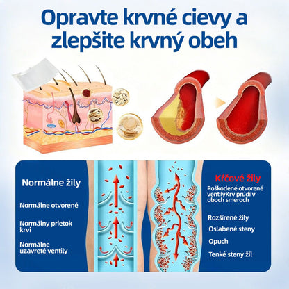 👩‍⚕️✅ Healrize® VeinTarget mikrojihlová náplasť ⚡ Okamžitá úľava, dlhodobé výsledky